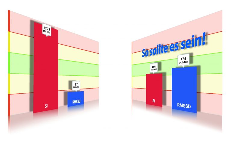 Regulation des VNS